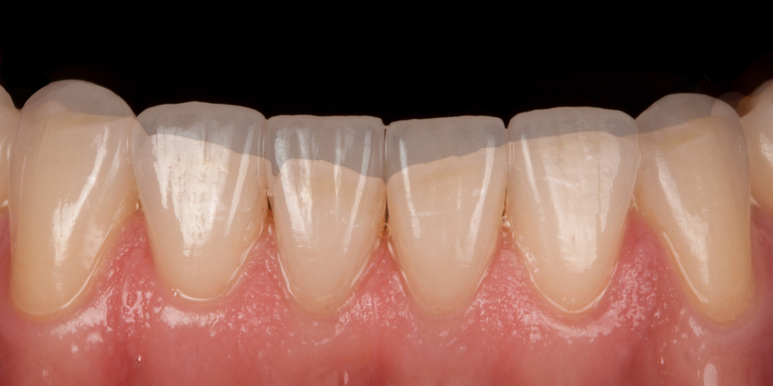 Dentallabor Daniel Lange - Gesamtsanierung in Vollkeramik